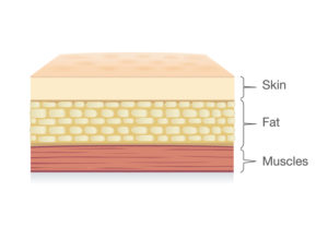 Anatomy of skin, fat and muscle